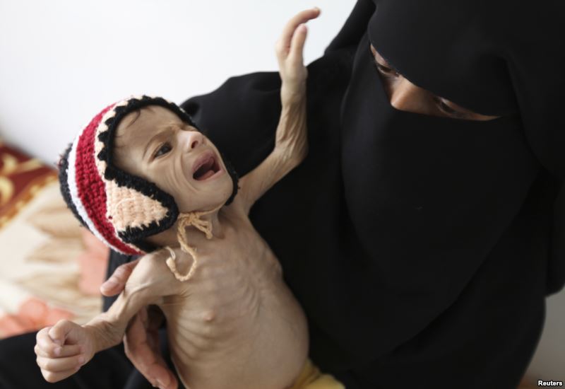 İHH’dan Yemen’de insani kriz raporu