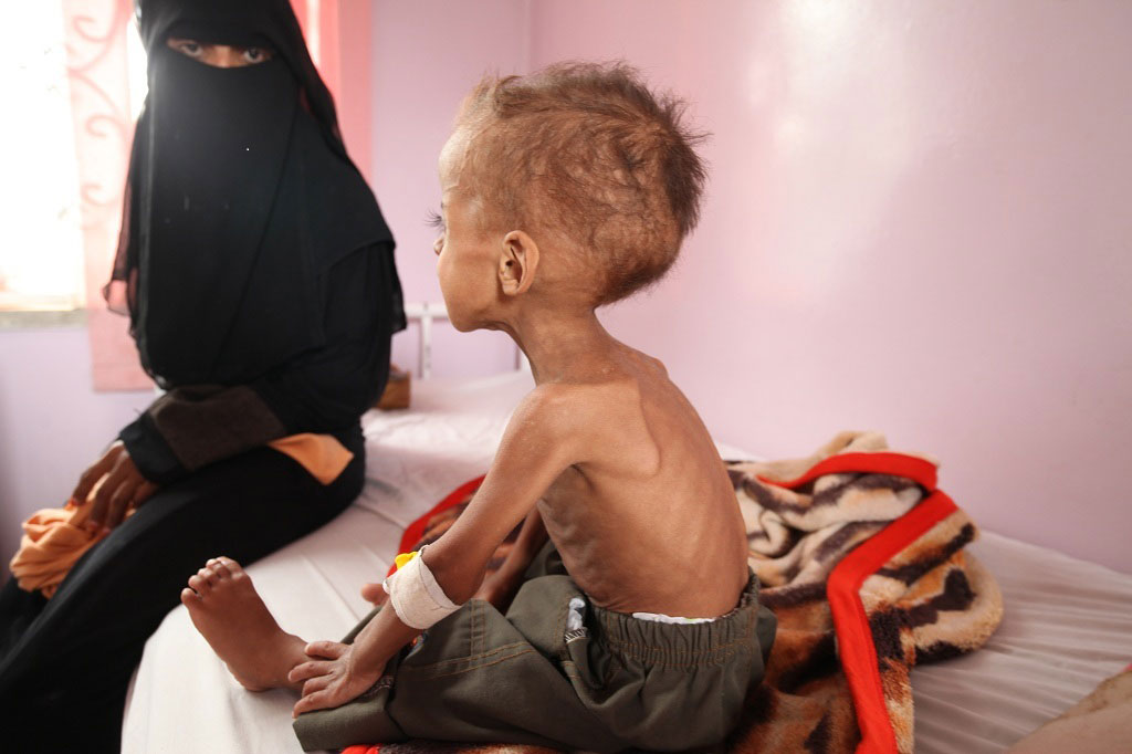 İHH’dan Yemen’de insani kriz raporu
