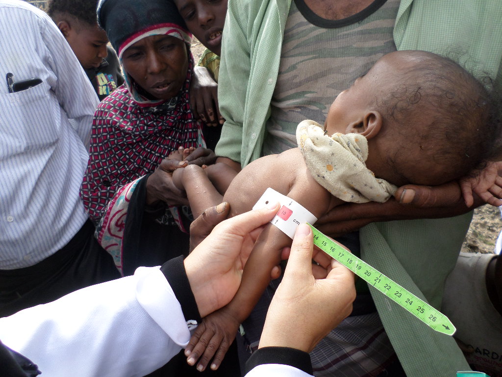 İHH’dan Yemen’de insani kriz raporu