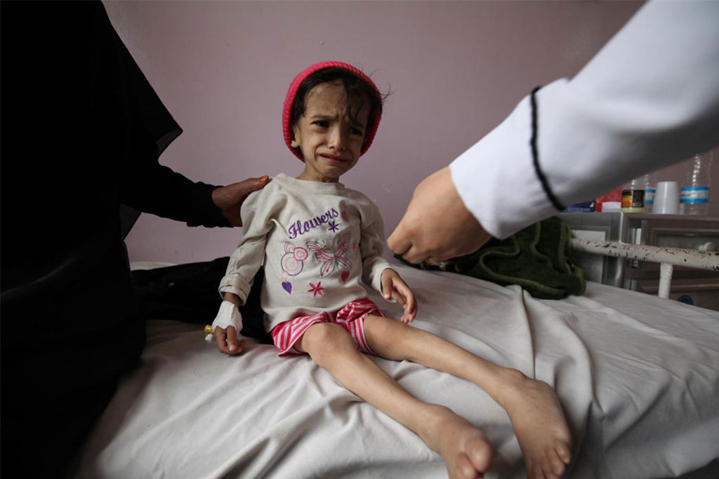İHH’dan Yemen’de insani kriz raporu