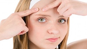 Hormonlar cildi direk etkiliyor