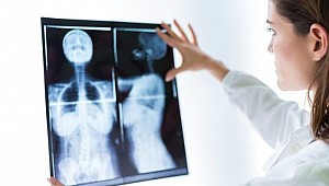 İngiltere'de göğüs taraması skandalı! 270 kadın meme kanserinden ölmüş olabilir