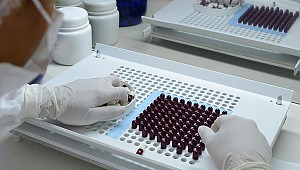 AB'de dirençli bakteriler her yıl 33 bin kişiyi öldürüyor