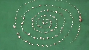 Çocuğun ağzından 526 diş çıkarıldı