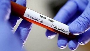 Gün Gün Koronavirüs Belirtileri nelerdir ? ONLINE KORONAVİRÜS TESTİ İÇİN TIKLAYIN