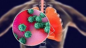 Ülkemizde COVID-19 vakası var mıdır? 17 soru 17 cevapla koronavirüs