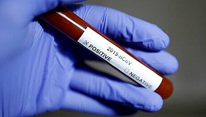 ABD'de 5 bebekte Kovid-19 tespit edildi