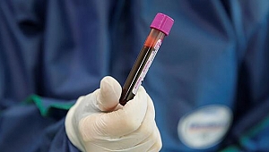 Dünyada koronavirüs vaka sayısı 2 milyon 800 bini aştı