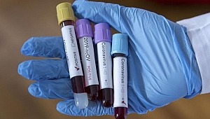 İstanbul Büyükşehir Belediyesi nde 90 personelin Covid-19 testleri pozitif çıktı