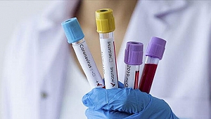 Türkiye’(Kovid-19) ile mücadelede örnek bir ülke