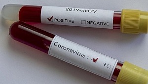 Türkiye’nin şimdi kendi tedavi yöntemini uygulaması ile Hasta sayısı azaldı