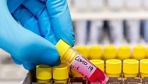 Hindistan'da Covid-19 vakalarında rekor artış 