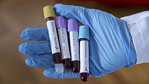 Ülkede alarm! İlk koronavirüs vaka şüphesi