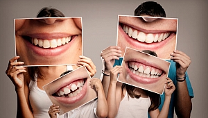 Estetik dişlerin sırrı invisalign tedavisinde!