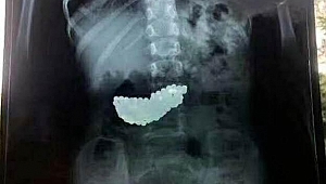 Küçük çocuk 2 ay boyunca böyle yaşadı! Çin'de inanılmaz olay