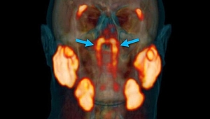 Bilim insanları, kafatasında yeni bir organ bulduklarını açıkladı