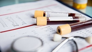 ​Kan Bağışı Yapmak Hayat Kalitesini Yükseltiyor 