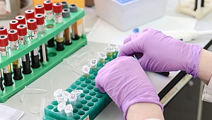 MPV Nedir? MPV Değeri Kaç Olmalıdır? Düşüklüğü ile Yüksekliği Nedenleri ve Belirtileri