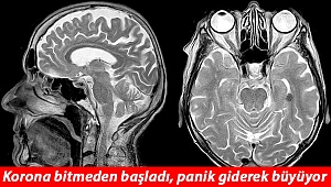 Korona salgını bitmeden başladı... Kanada'da 'gizemli' beyin hastalığı panik yarattı!