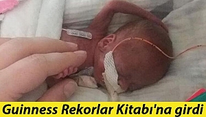 Doktorlar 'yaşayamaz' demişti... Guinness Rekorlar Kitabı'na girdi