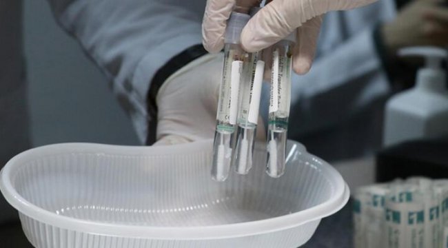 İsveç'te PCR testi skandalı! İnceleme başlatıldı