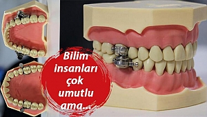 Kilo kontrol cihazına tepki yağıyor... 'Bunun adı işkence!'