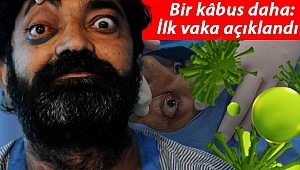 Bu kez de 'yeşil mantar' vakası görüldü! Hindistan'da kâbus bitmiyor...