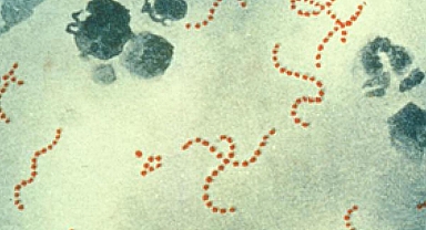 İngiltere’de Strep A’ya bağlı ölümler 122’ye ulaştı