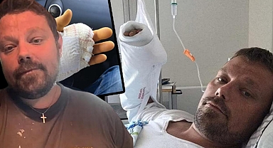 Kedi ısırığı sonrası hayatını kaybetti! 15 ameliyat geçirdi, parmağı kesildi ama kurtulamadı...