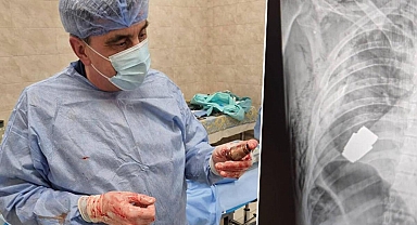 Dünyanın en şanslı askeri... Vücuduna el bombası saplandı! Doktorlar patlamadan çıkarmayı başardı