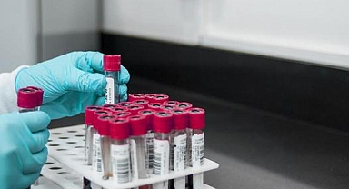 İngiltere’de bulaşıcı cinsel hastalıklar rekor seviyeye yükseldi