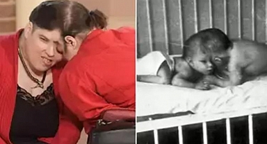 Dünyanın en yaşlı yapışık ikizleri hayatlarını kaybetti