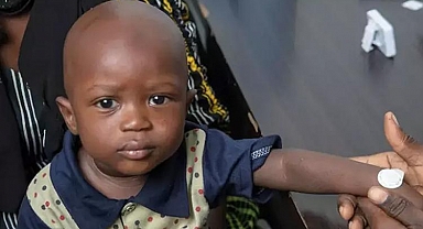 Gambia’da yürütülen mikro iğneli bant aşı testinin sonuçları başarılı
