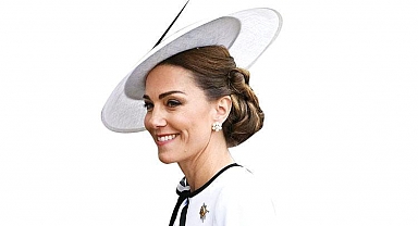 Prenses Kate’in saçları neden dökülmedi