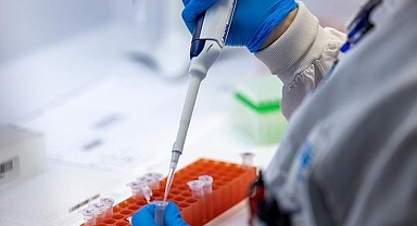 Avrupa'da Maymun çiçeği alarmı! Risk düşük ancak 'hazırlıklı olun' uyarısı geldi