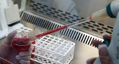 'Bilinmeyen hastalık' alarma geçirdi: Afrika ülkesinde çok sayıda ölü