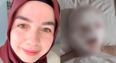 Avcılar'da ikinci Bergen vakası: Yüzüne kezzap atıp gözlerini kör etti! Talihsiz kadın yürek sızlattı: 