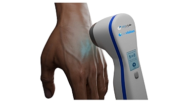 Genç Mühendislerden Sağlığa Katkı: Vitiligo İçin Taşınabilir Fototerapi Cihazı Geliştirdiler