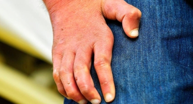 AB Ülkelerinde Yıllar Sonra Cüzzam Vakaları: Romanya ve Hırvatistan’da Alarm