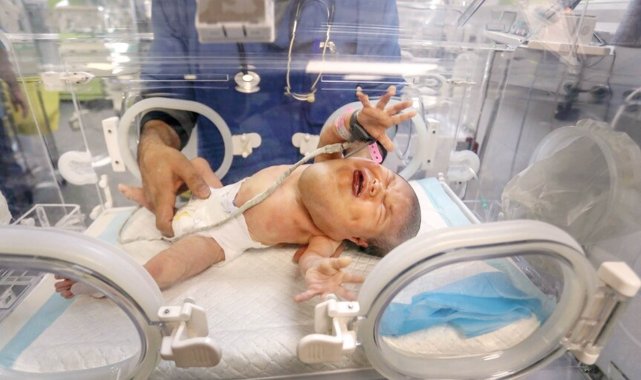 Gazze’de İnsanlık Dramı Derinleşiyor: Bebek Maması Krizi Büyüyor, On Binlerce Çocuk Hayatını Kaybetti