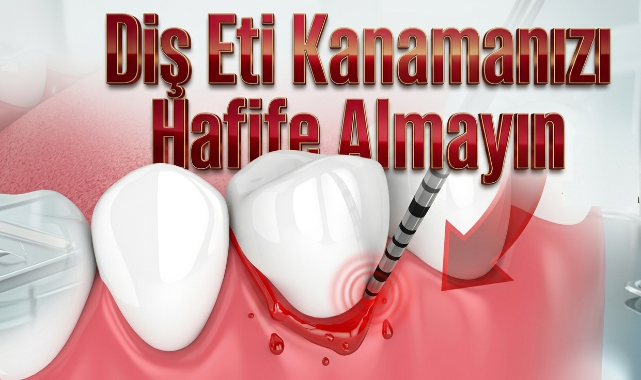 Diş Eti Kanamasını Hafife Almayın: Ciddi Hastalıkların Habercisi Olabilir