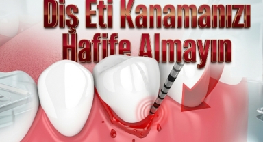 Diş Eti Kanamasını Hafife Almayın: Ciddi Hastalıkların Habercisi Olabilir 