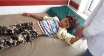 Yemen'de kolera salgını tüm ülkeye yayıldı